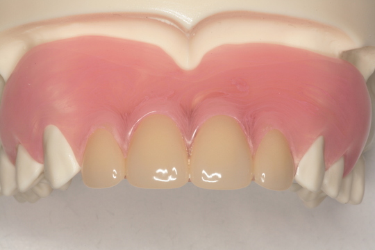 無痛デンチャーの臨床 無痛デンチャーの臨床 無痛デンチャーの臨床 製品紹介｜株式会社